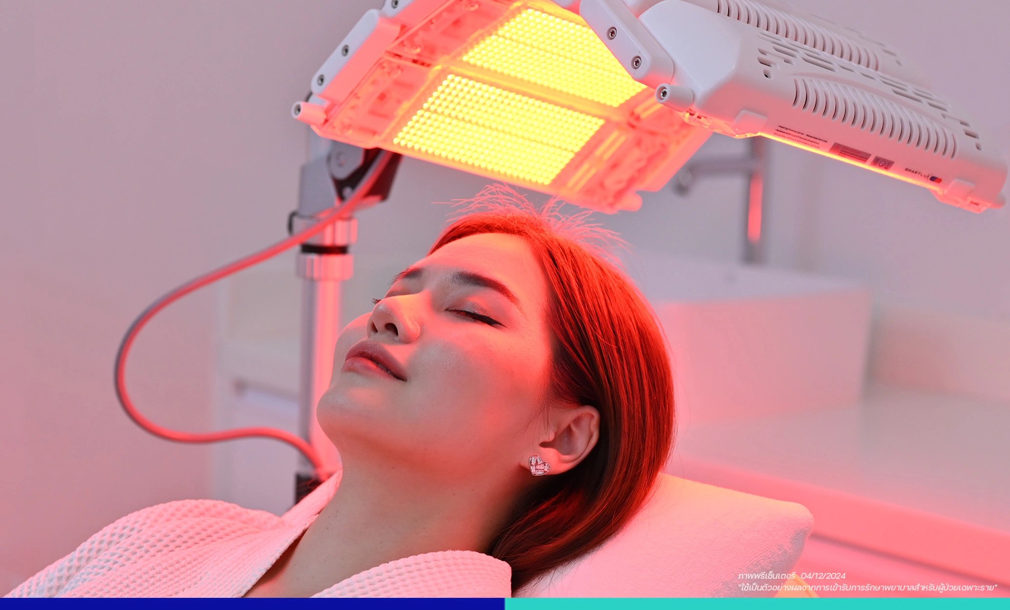 ฉายแสงเลเซอร์กระตุ้นราก