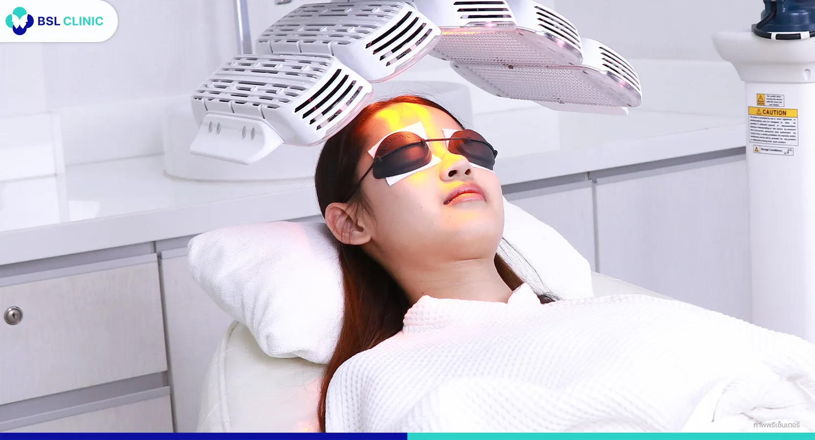 สิวขึ้นคาง