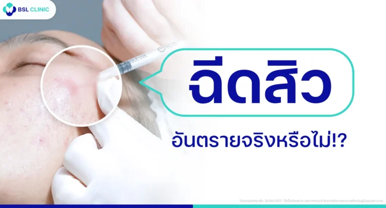 ฉีดสิว