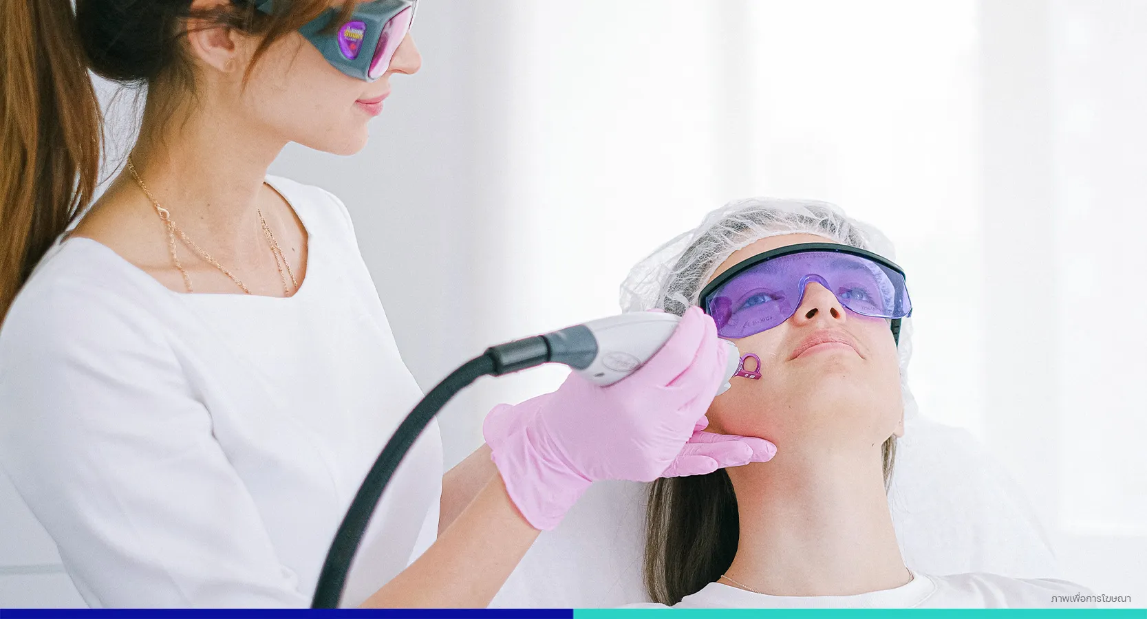 สาเหตุของฝ้า