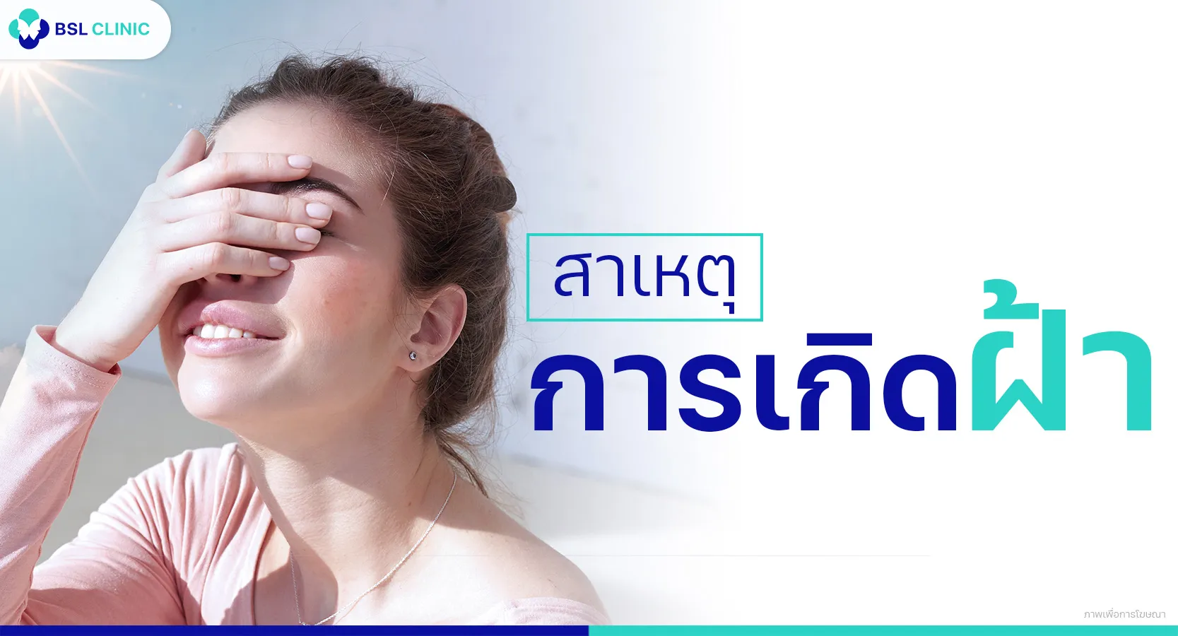 สาเหตุของฝ้า