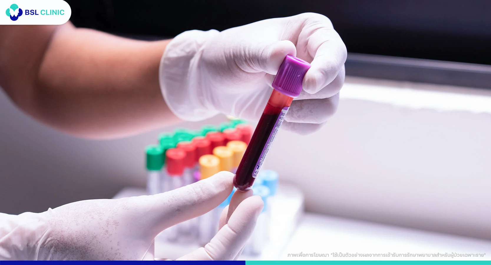 ดูดไขมันต้องตรวจเลือดไหม ?