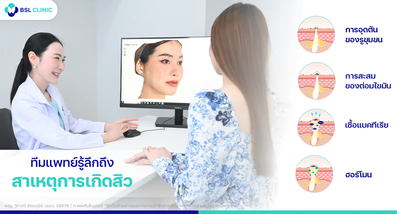 หมอรักษาสิวที่ไหนดี