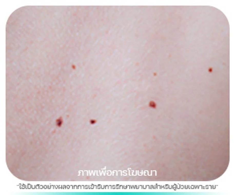 ขี้แมลงวัน