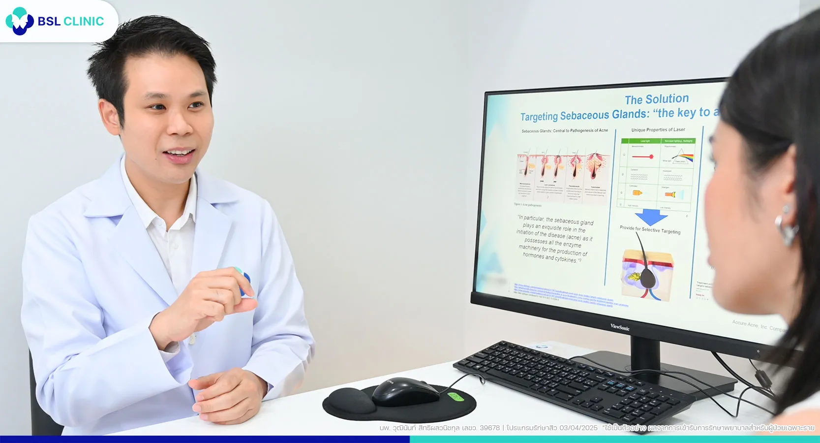 รักษาสิวอุดตัน