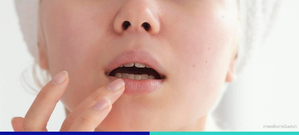 ริมฝีปากคล้ำ
