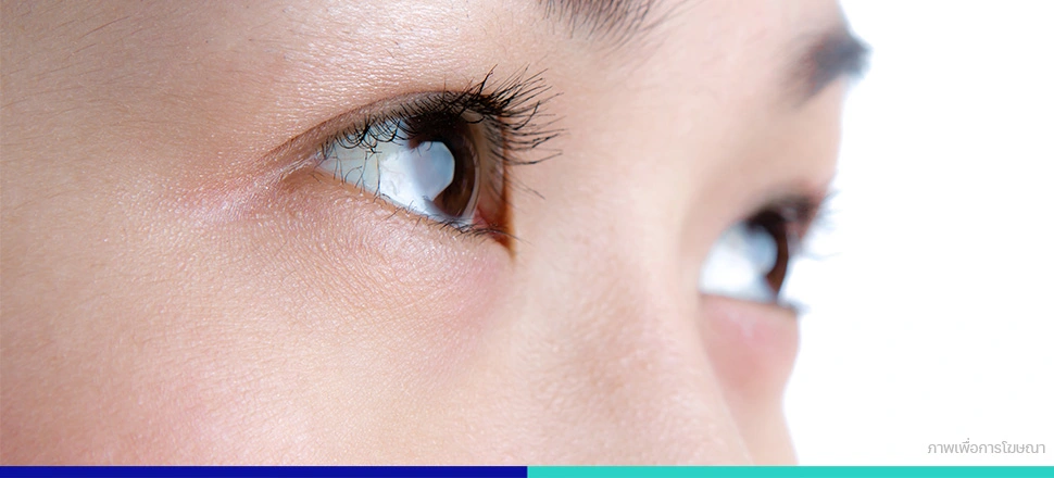 ใต้ตาคล้ำ ใต้ตาดำ