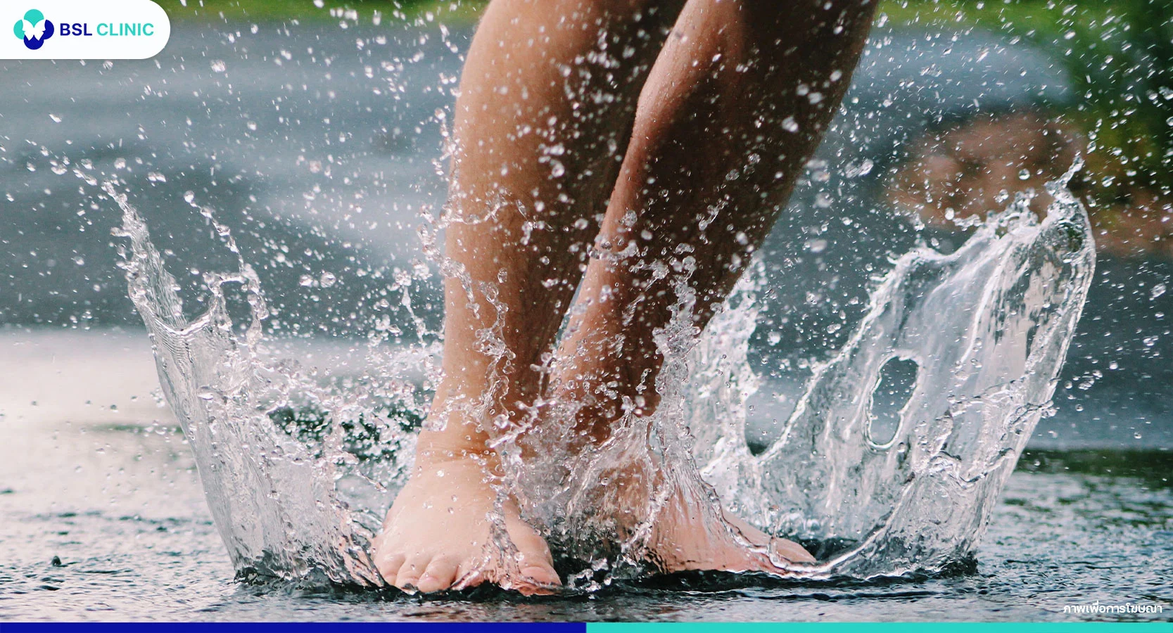 ผื่นเชื้อราหน้าฝน