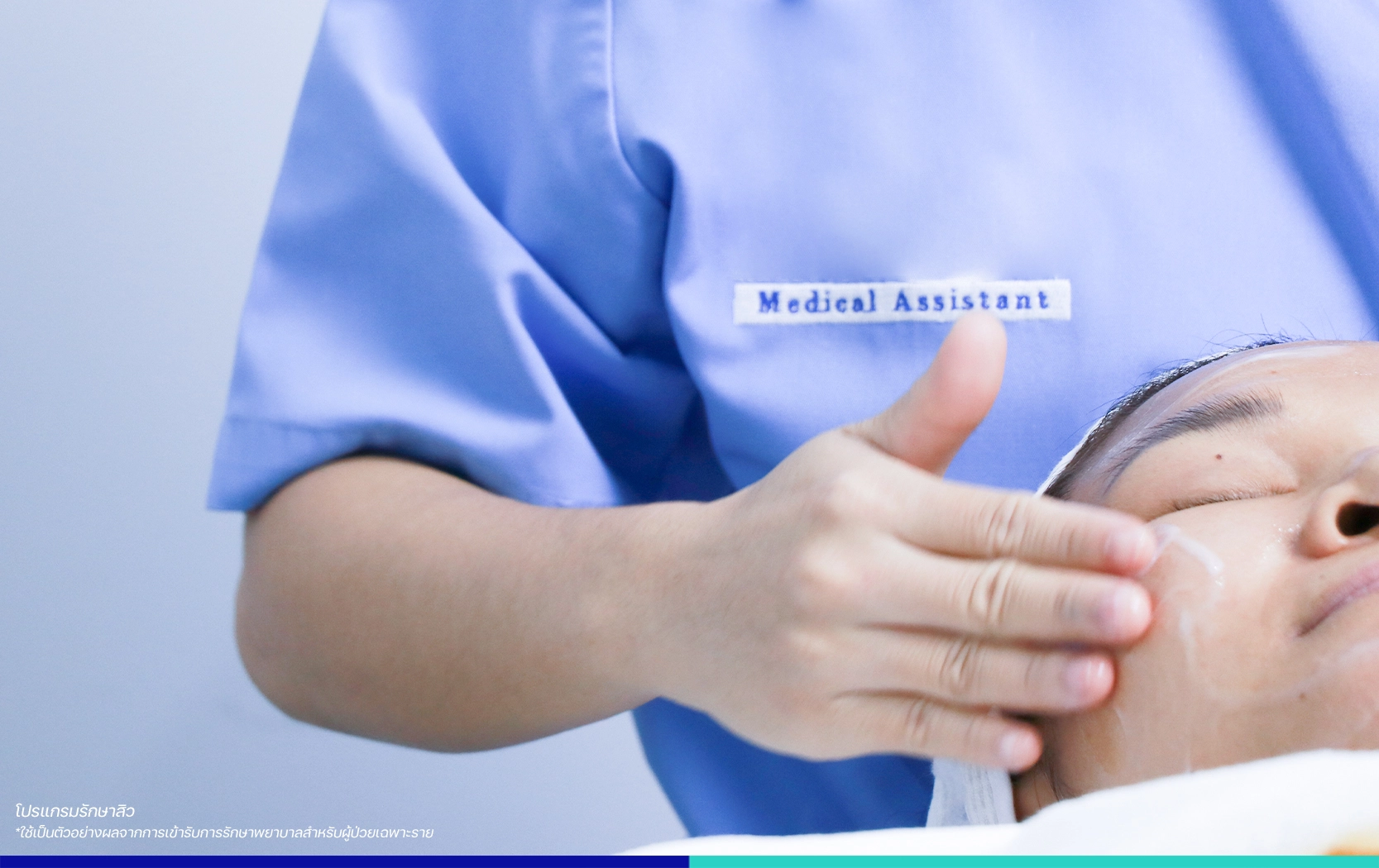 รีวิว BSL รักษาสิวดีไหม