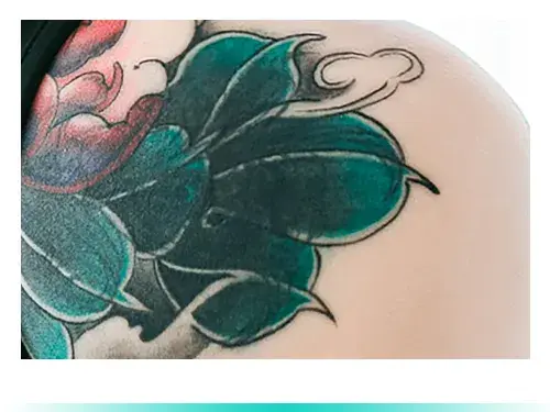 ลบรอยสักสีเขียว