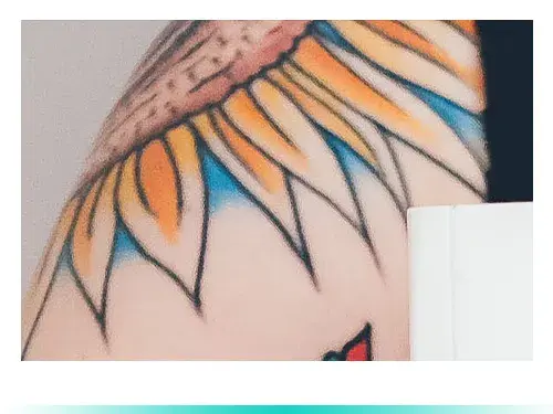 ลบรอยสักสีเหลือง