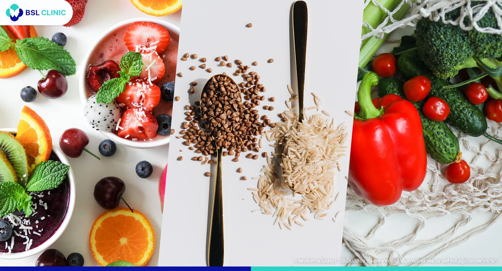 ภาวะเครียดจากอนุมูลอิสระ