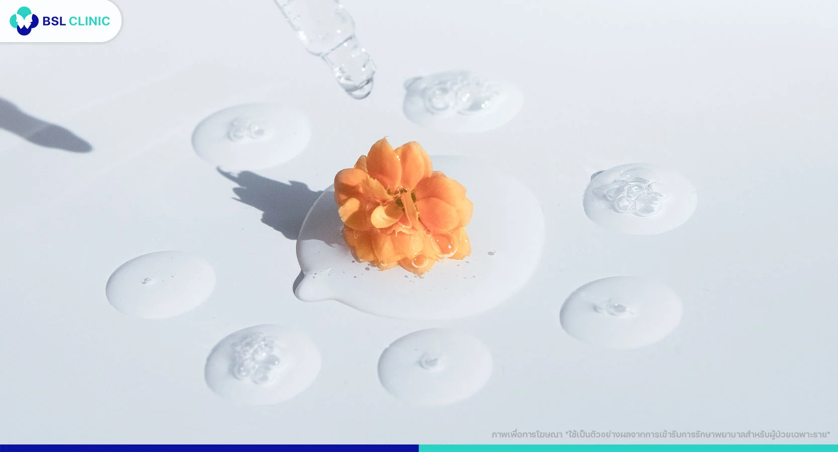 มอยเจอร์ไรเซอร์