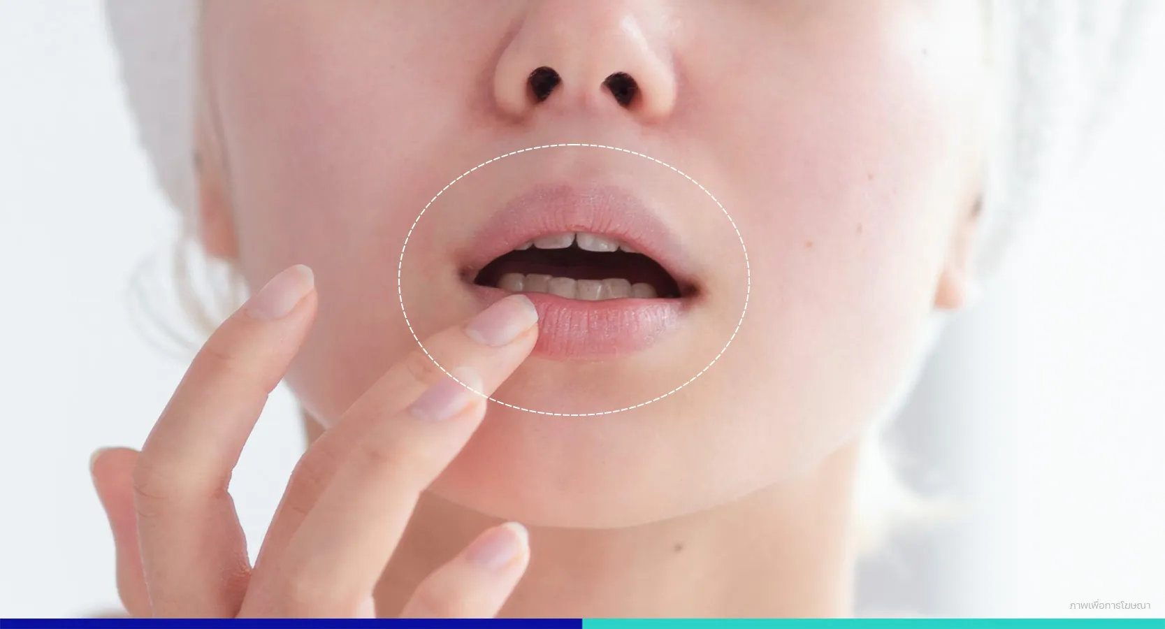 ปากแห้งลอก