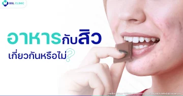 อาหารกับสิว