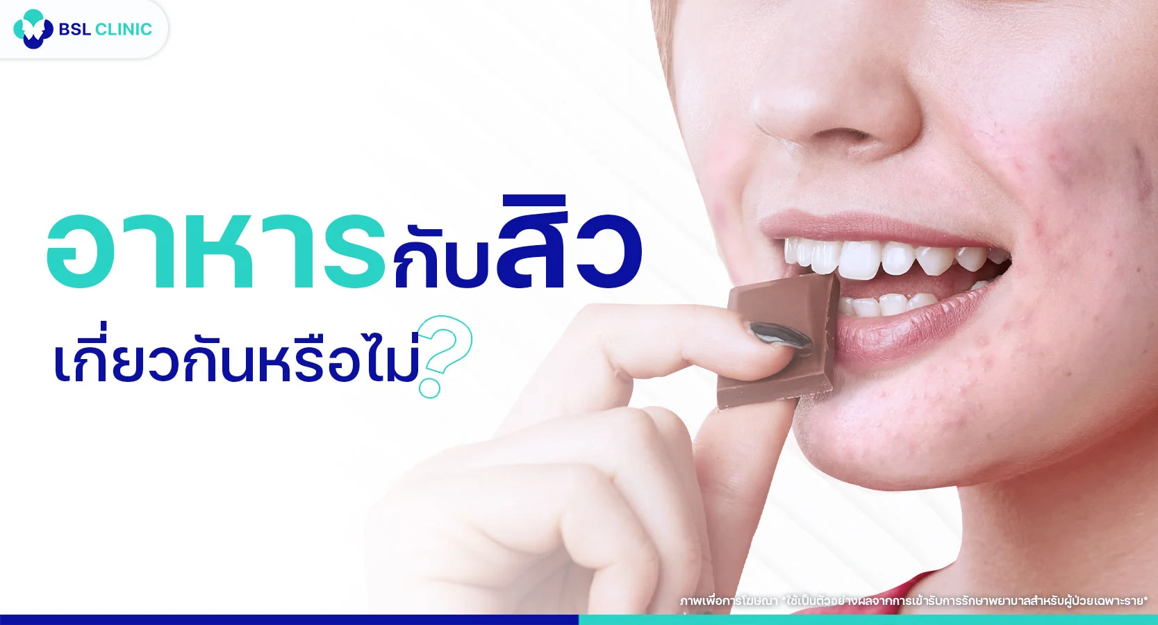 อาหารกับสิว