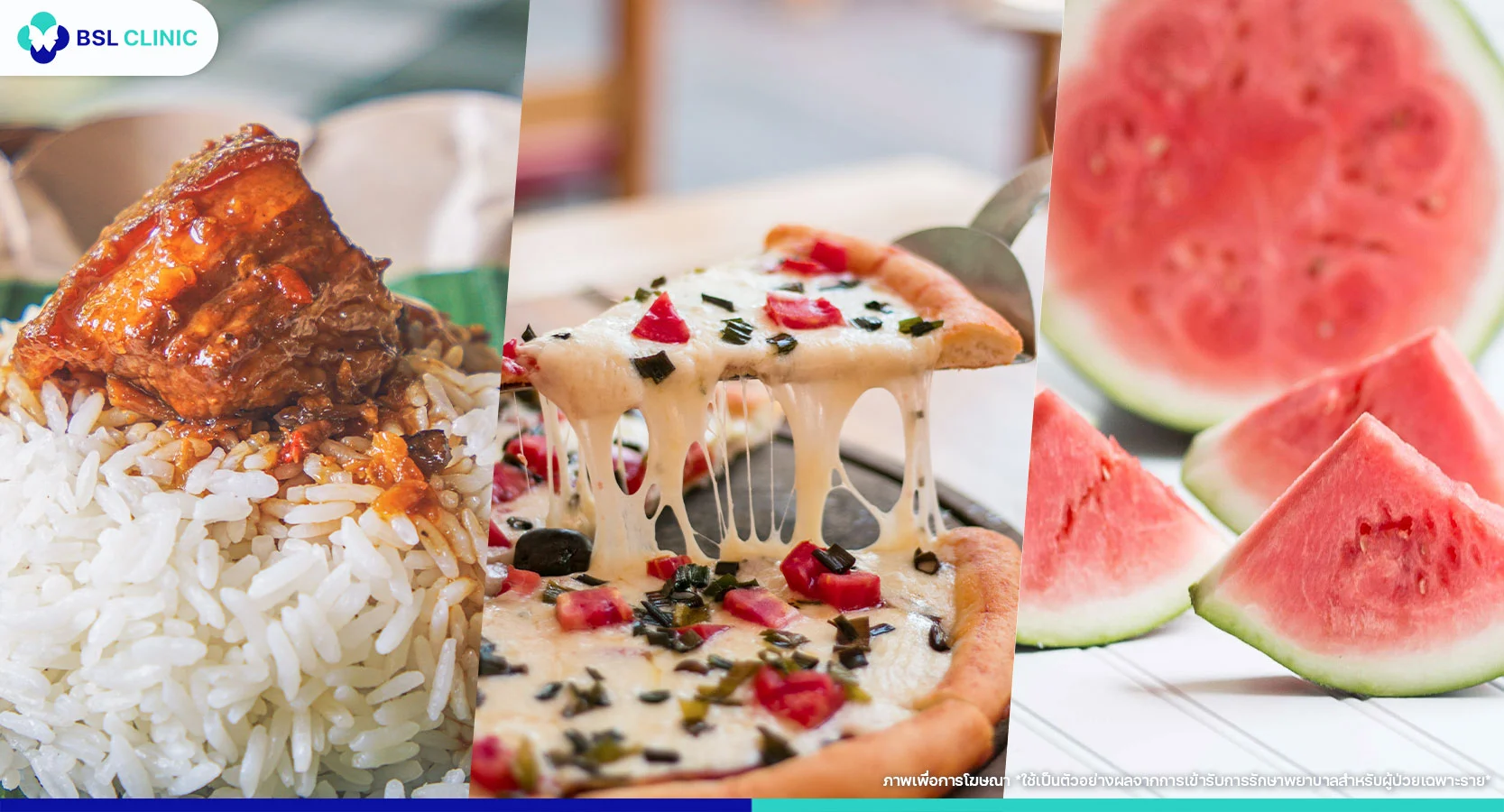 อาหารที่ทำให้เกิดสิว