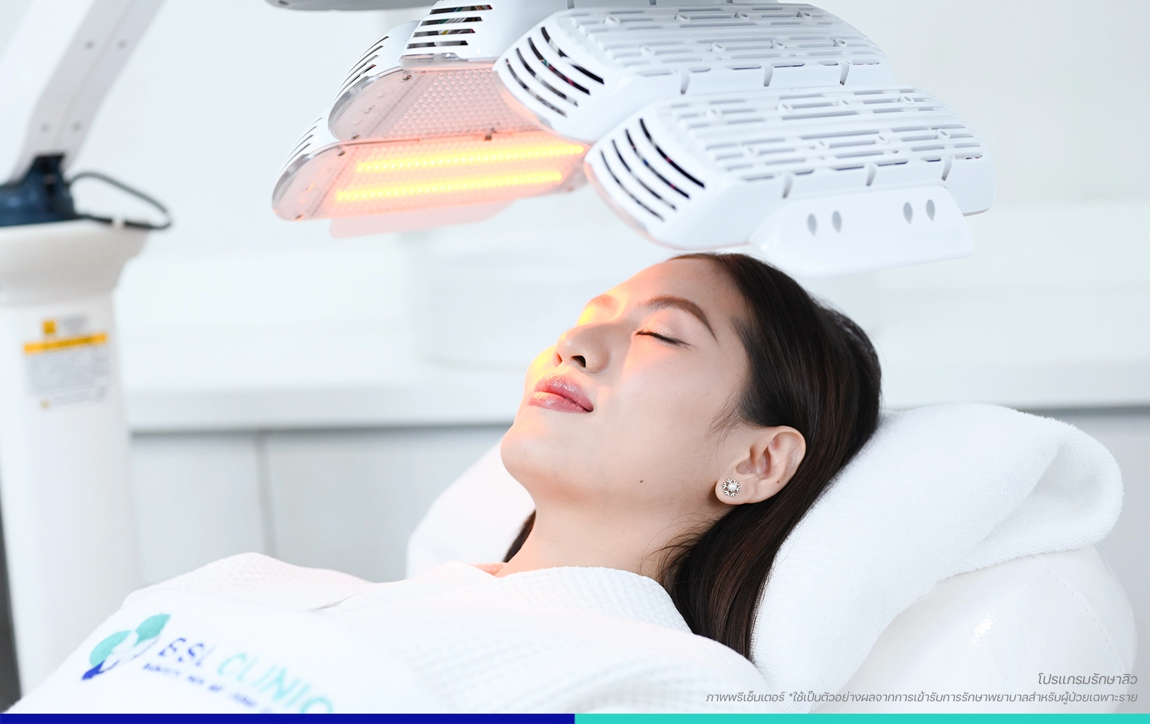 ฉายแสงรักษาสิว ACNE LIGHT THERAPY