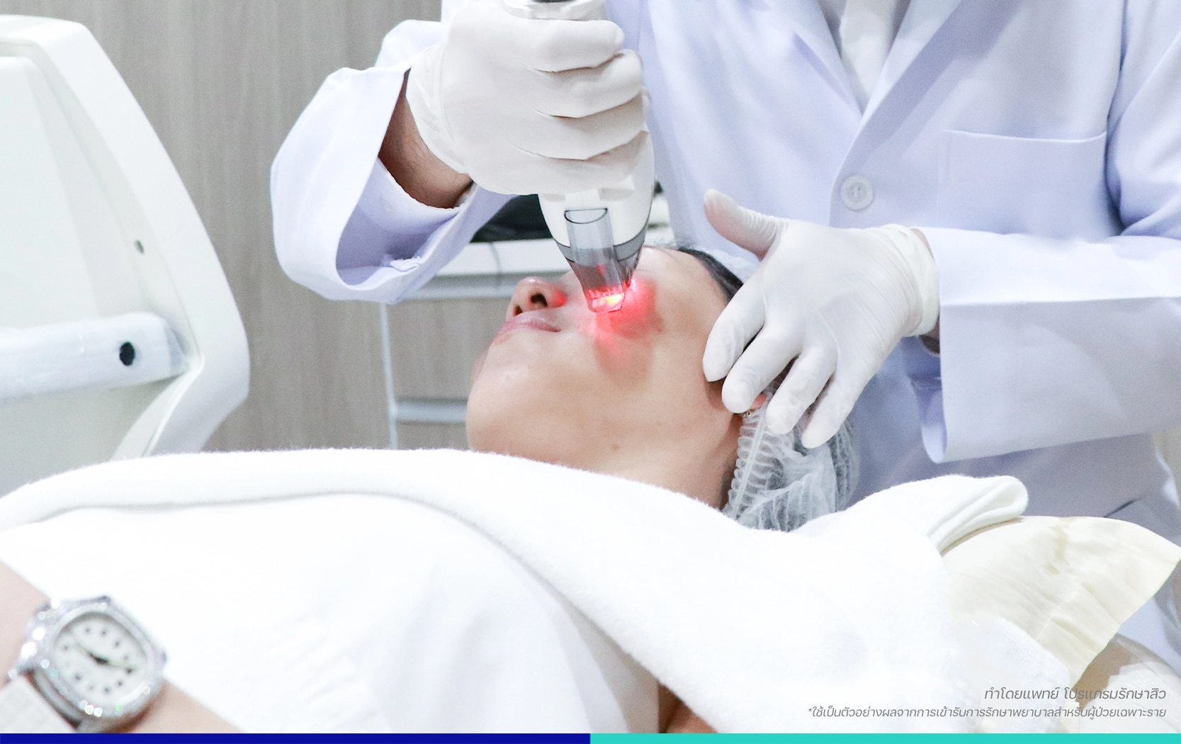 การรักษาสิว รอยสิว ผิวแพ้ง่าย แห้งลอก หน้าแดงบาง