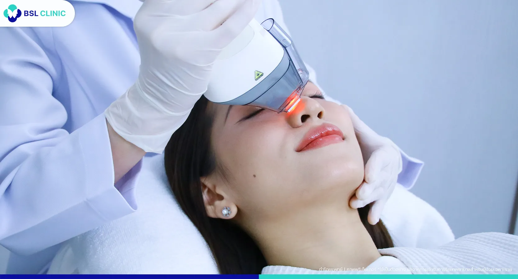 วิธีรักษาสิวฮอร์โมน