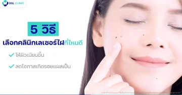 เลเซอร์ไฝที่ไหนดี