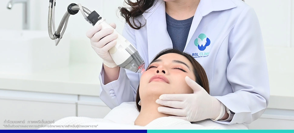 เลเซอร์ผิวรอบดวงตา