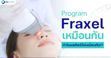 เลเซอร์ Fraxel Program
