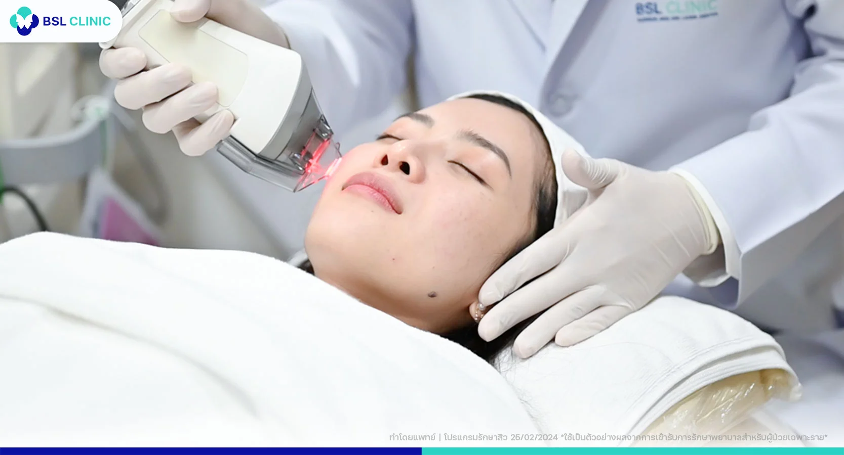 เลเซอร์ Fraxel Program