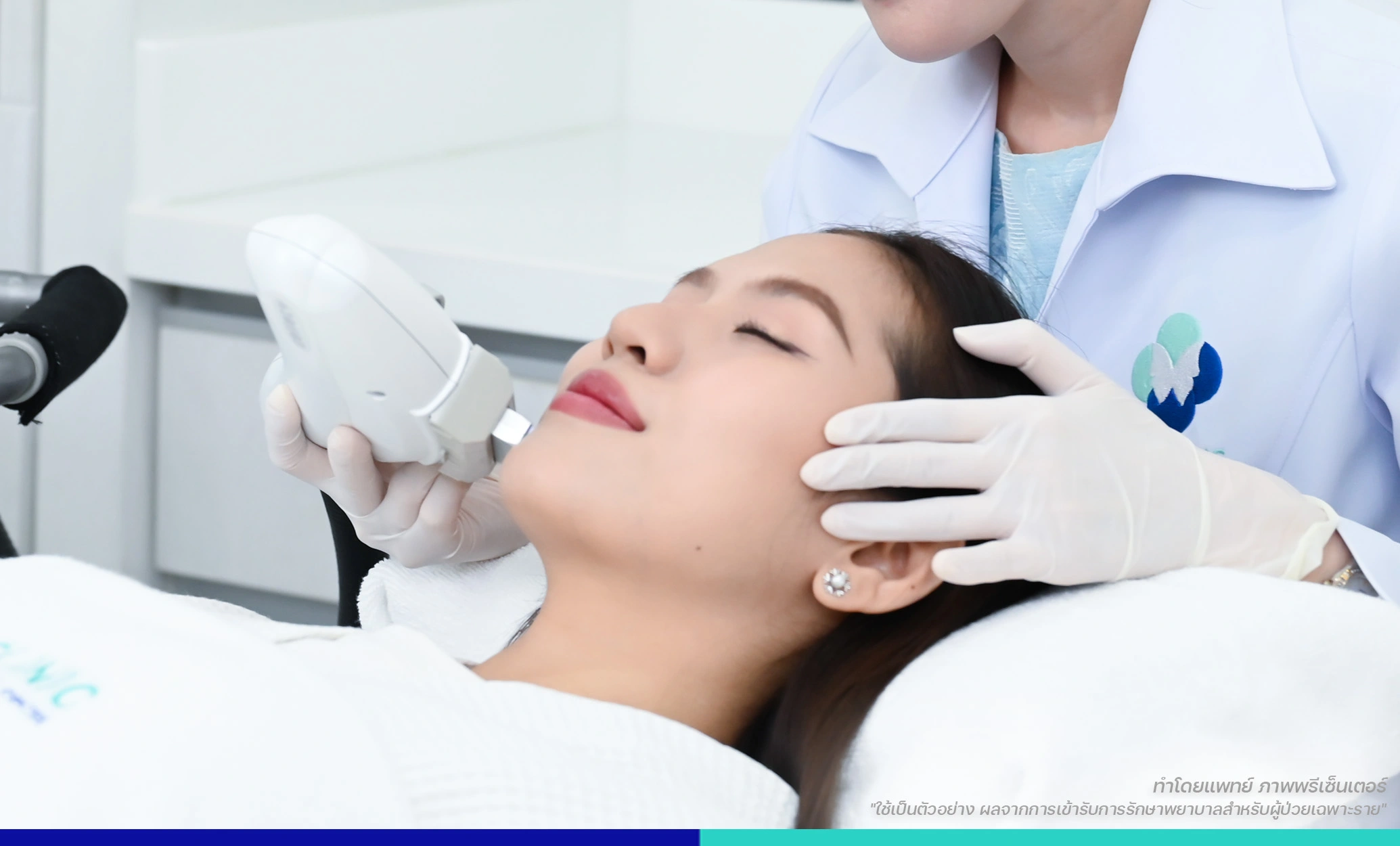 เลเซอร์B&C