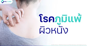 โรคภูมิแพ้ผิวหนัง