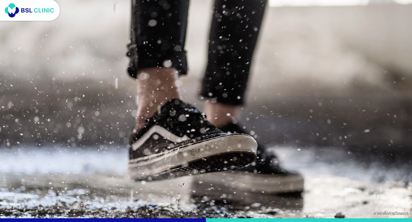 ผื่นเชื้อราหน้าฝน