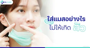 ใส่แมสเป็นสิว