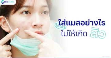 ใส่แมสเป็นสิว