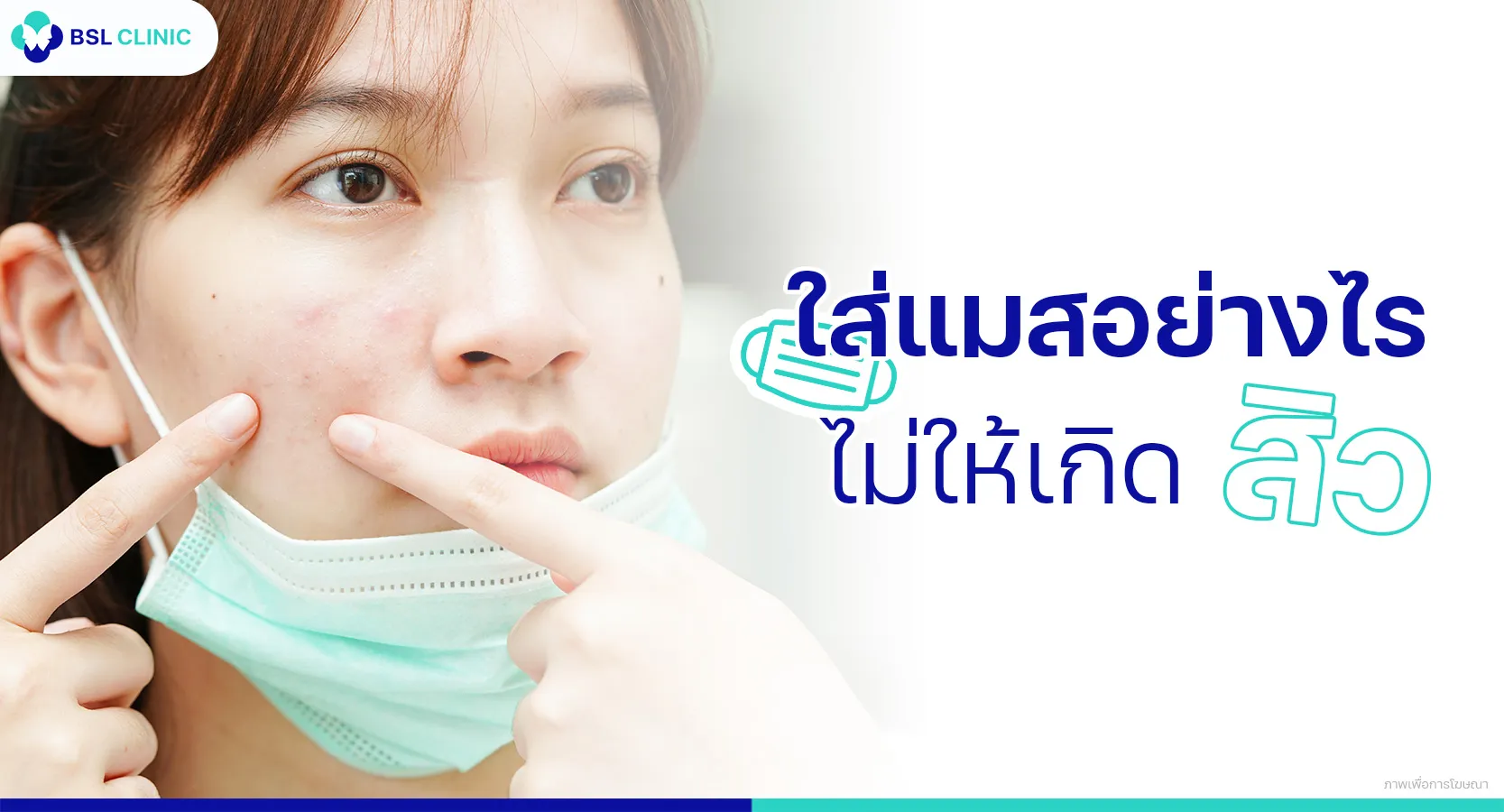 ใส่แมสเป็นสิว