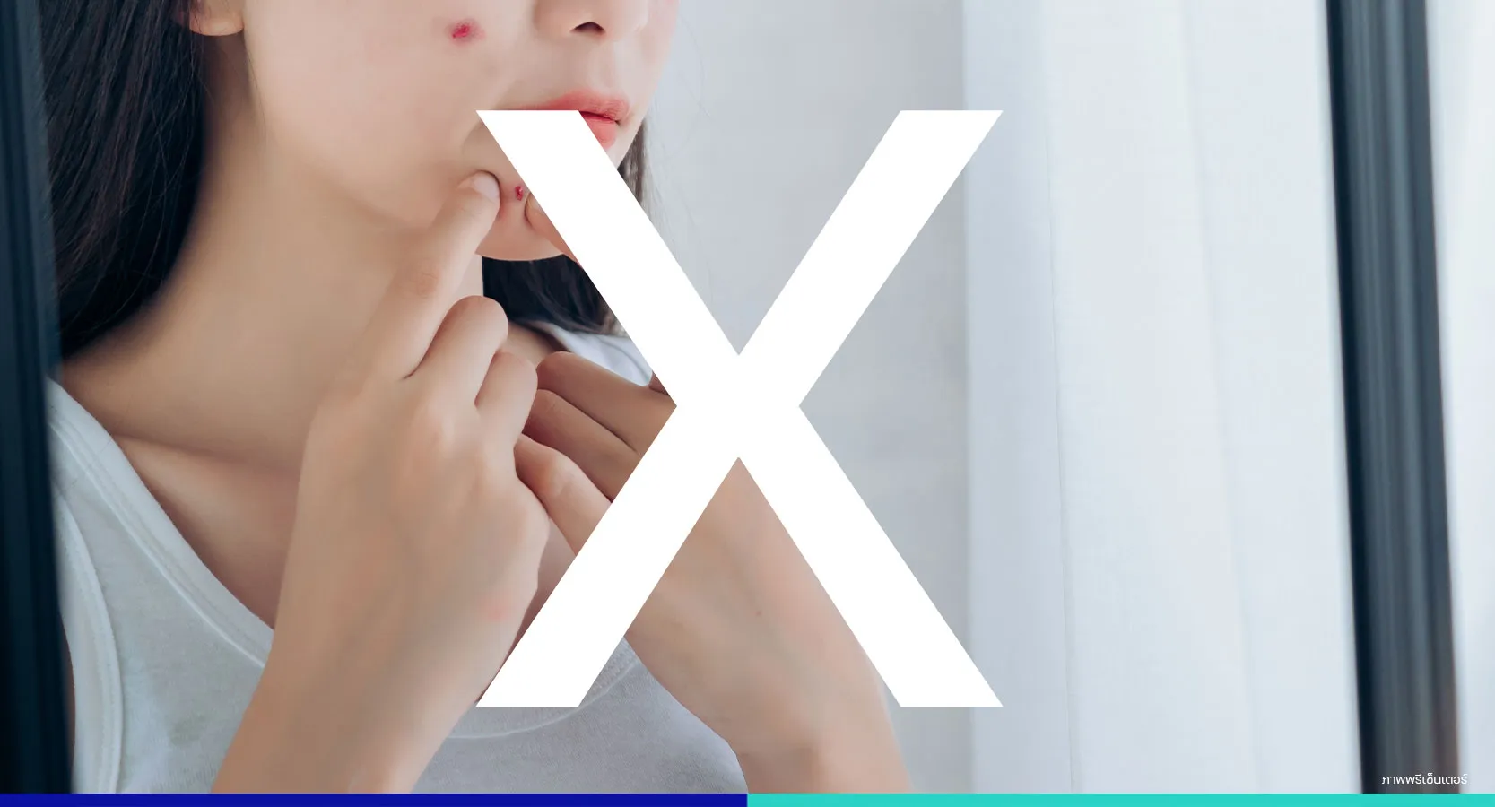 รักษาสิวอุดตัน