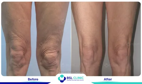 รีวิวกระชับสัดส่วน