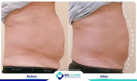 รีวิวกระชับสัดส่วน