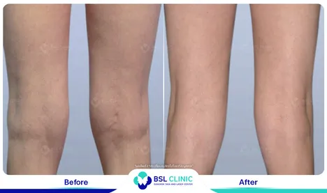 รีวิวกระชับสัดส่วน