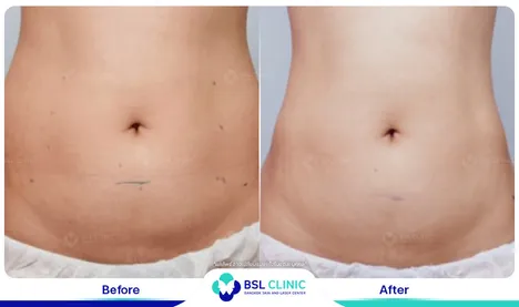 รีวิวกระชับสัดส่วน