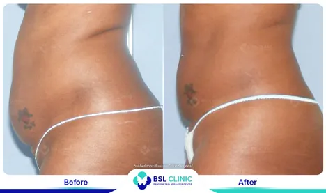 รีวิวกระชับสัดส่วน