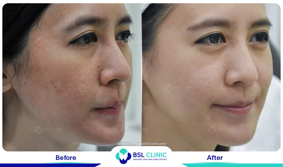 รีวิวผิวแพ้ง่าย