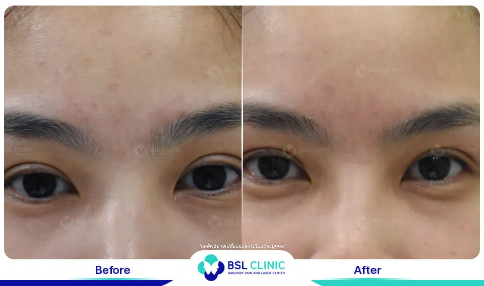 รีวิวผิวแพ้ง่าย