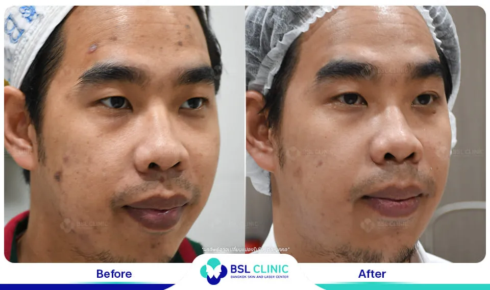 รีวิวผิวกระจ่างใส