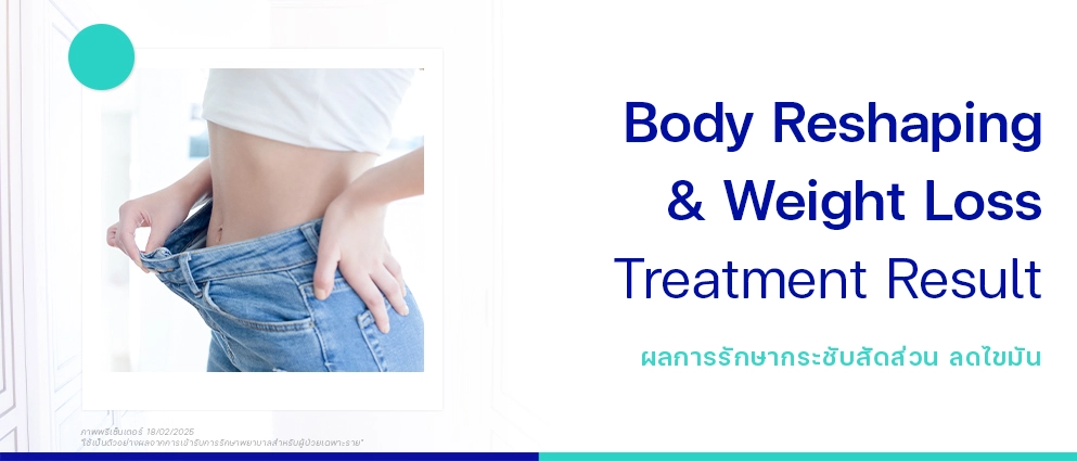 รีวิวกระชับสัดส่วน