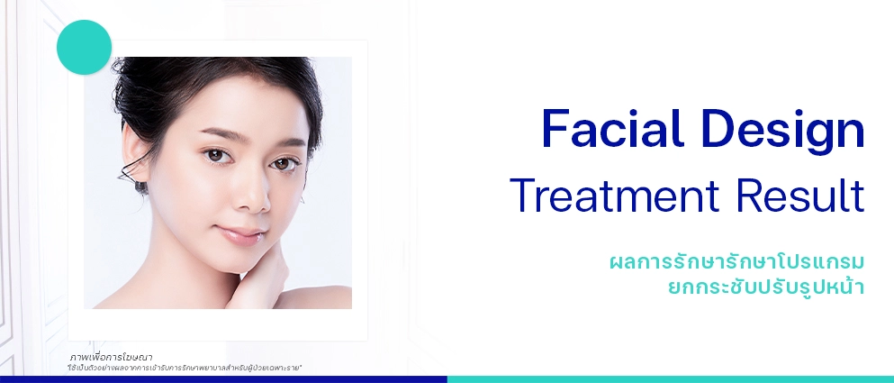 รีวิวยกกระชับปรับรูปหน้า