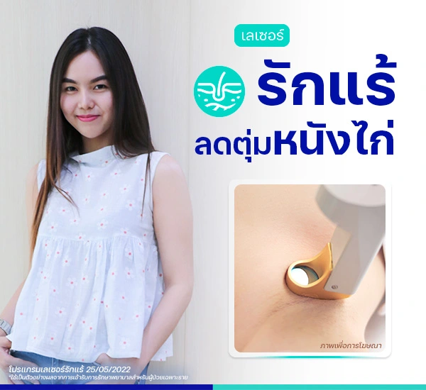รีวิวลดเหงื่อรักแร้