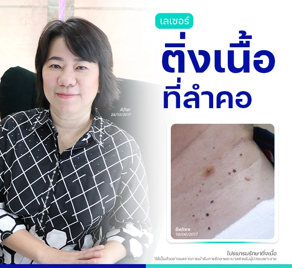 รีวิวติ่งเนื้อกระเนื้อ