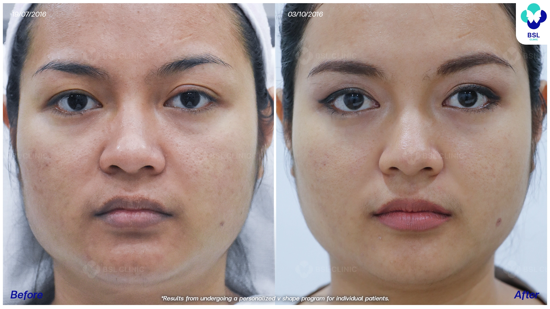 หน้าเรียว