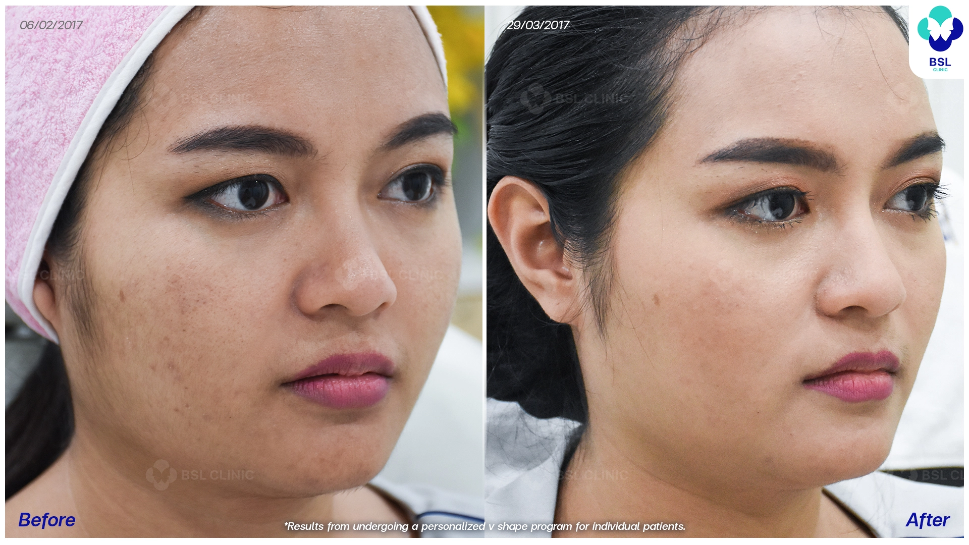 หน้าเรียว