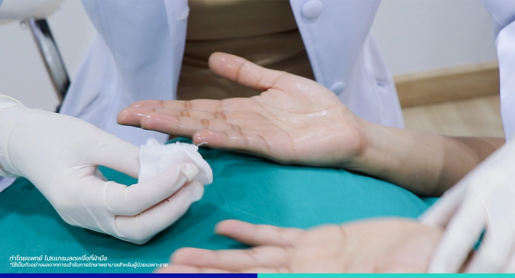 วิธีการรักษาเหงื่อออกมาก